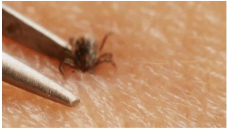 【虫害预警】危险!不是昆虫的“虫”野外活动可别因它中招了(图4)